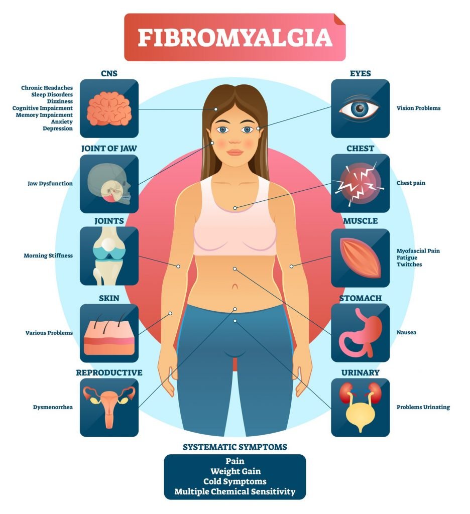 Fibromialgia: affrontiamola insieme | XXI SECOLO