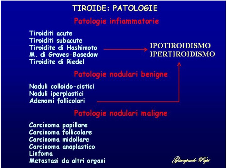 tiroiditi